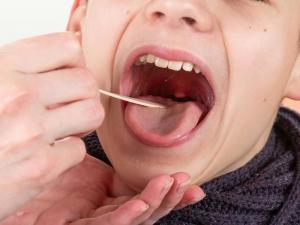 Кістка в горлі – що робити?